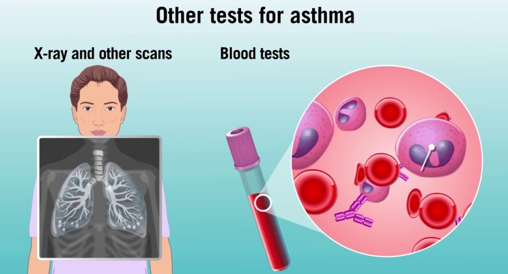 Asthma Diagnosis and Tests